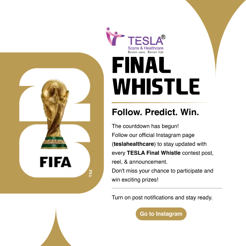 World cup