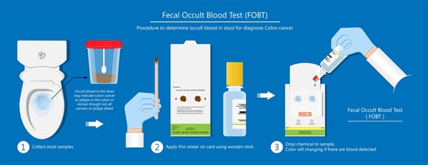 Amazing At Home Stool Test in 2023 Learn more here 