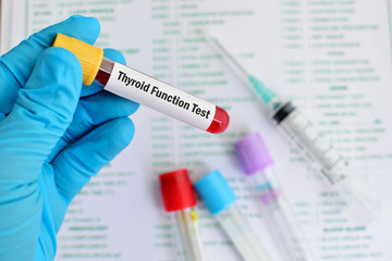 Thyroid Function Tests- Purpose, Procedure And Results | Blog