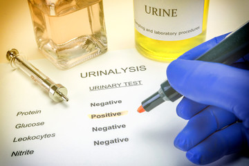 urine bile salt test
