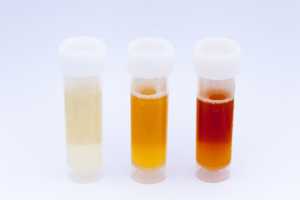 urine routine test