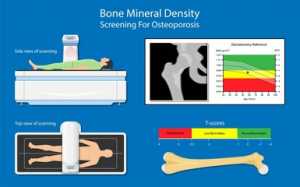 bone density test